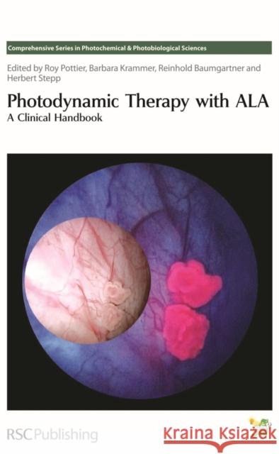 Photodynamic Therapy with ALA: A Clinical Handbook  9780854043415 0