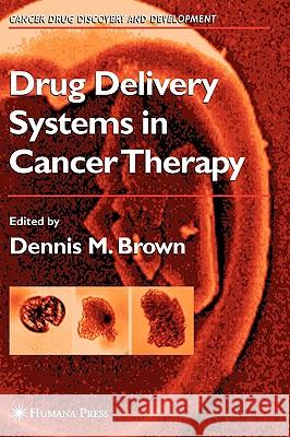Drug Delivery Systems in Cancer Therapy Dennis M. Brown 9780896038882 Humana Press