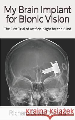 My Brain Implant for Bionic Vision: The First Trial of Artificial Sight for the Blind Richard B. McDonald 9781081018801 Independently Published