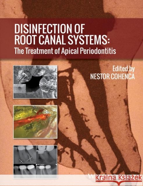 Disinfection of Root Canal Systems: The Treatment of Apical Periodontitis Cohenca, Nestor 9781118367681 John Wiley & Sons