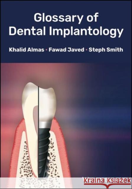 Glossary of Dental Implantology Khalid Almas Javed                                    Steph Smith 9781118626887 Wiley-Blackwell