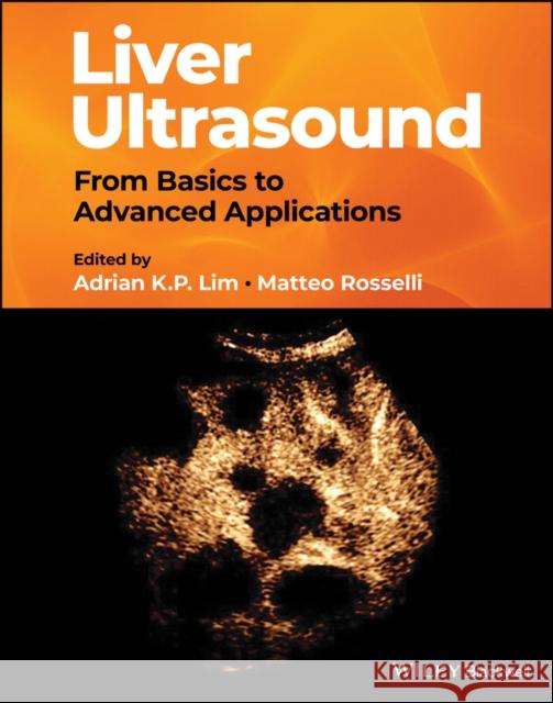 Liver Ultrasound: From Basics to Advanced Applications Lim, Adrian 9781119612599 John Wiley and Sons Ltd