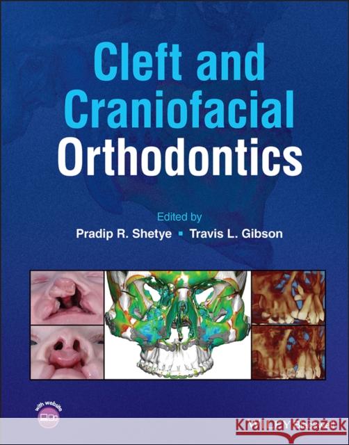 Cleft and Craniofacial Orthodontics  9781119778349 