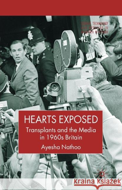 Hearts Exposed: Transplants and the Media in 1960s Britain Nathoo, A. 9781349541355 Palgrave MacMillan