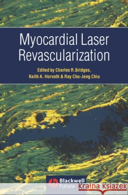 Myocardial Laser Revascularization Charles R. Bridges Keith A. Horvath Ray Chu-Jeng Chiu 9781405122108 Blackwell Futura