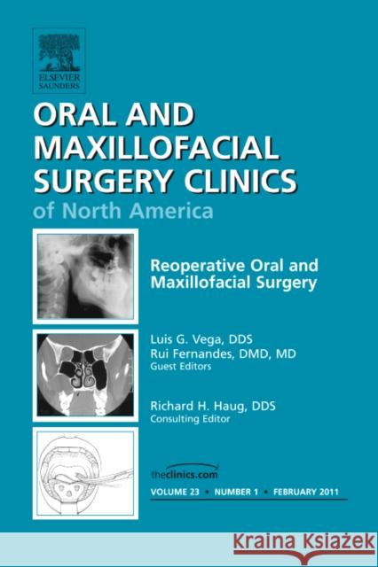 Reoperative Oral and Maxillofacial Surgery, an Issue of Oral and Maxillofacial Surgery Clinics: Volume 23-1 Fernandes, Rui 9781455704767 W.B. Saunders Company
