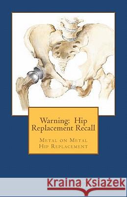 Warning: Hip Replacement Recall: Warning: Hip Replacement Recall Metal on Metal Devices Lisa G. Douglas 9781461042358 Createspace