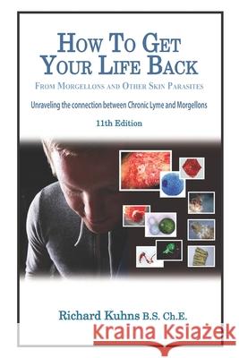 How to Get Your Life Back From Morgellons and Other Skin Parasites Limited Edit Kalmbah, Jonquelyn 9781475010527 Createspace