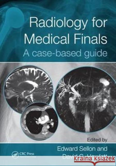 Radiology for Medical Finals: A Case-Based Guide Edward Sellon David Howlett 9781498782166 CRC Press