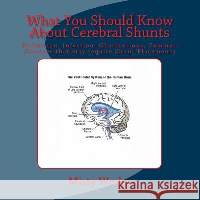 What You Should Know About Cerebral Shunts: Definition, Infection, Obstructions, Common Diseases that may require Shunt Placements Wesley, Misty Lynn 9781512085686 Createspace