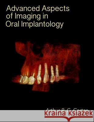 Advanced Aspects of Imaging in Oral Implantology Arthur Rodriguez Gonzalez Cortes 9781515311508 Createspace