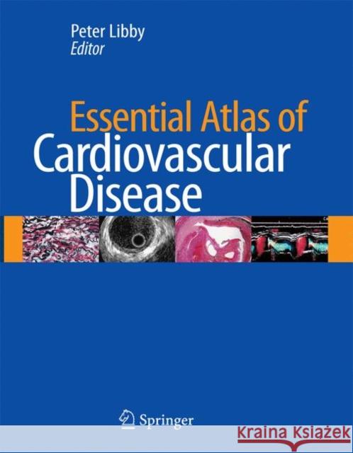 Essential Atlas of Cardiovascular Disease [With CDROM] Libby, Peter 9781573403092 Current Medicine