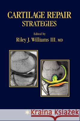 Cartilage Repair Strategies Riley J., III Williams Lars Peterson Brian J. Cole 9781588296290 Humana Press