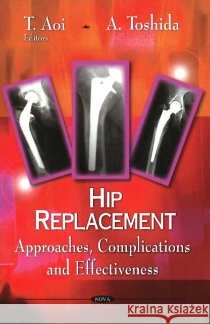 Hip Replacement: Approaches, Complications & Effectiveness T Aoi, A Toshida 9781606923269 Nova Science Publishers Inc