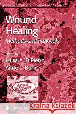 Wound Healing: Methods and Protocols DiPietro, Luisa A. 9781617372964 Springer