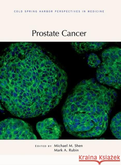 Prostate Cancer Michael Shen Mark Rubin 9781621821649 Cold Spring Harbor Laboratory Press,U.S.