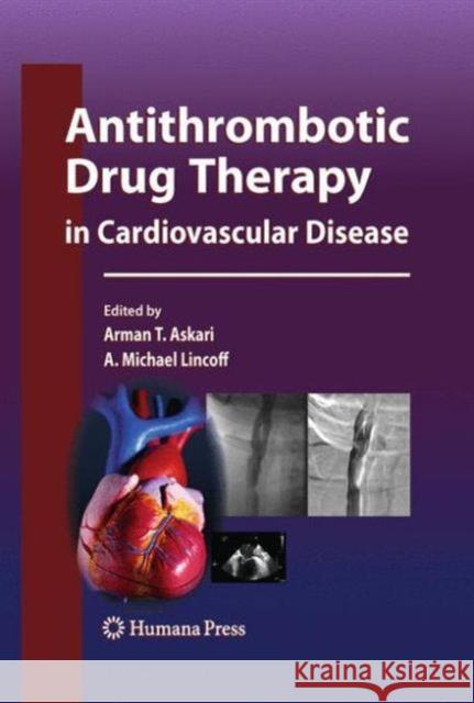 Antithrombotic Drug Therapy in Cardiovascular Disease Arman T Askari, MD A Michael Lincoff  9781627037976 Humana Press