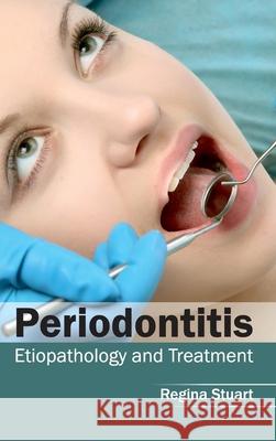 Periodontitis: Etiopathology and Treatment Regina Stuart 9781632413192 Hayle Medical