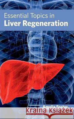 Essential Topics in Liver Regeneration Amelia Foster 9781632421821 Foster Academics