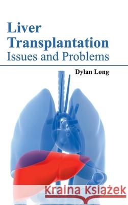 Liver Transplantation: Issues and Problems Dylan Long 9781632422576 Foster Academics