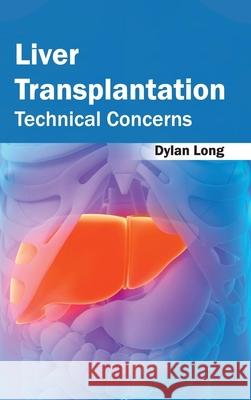 Liver Transplantation: Technical Concerns Dylan Long 9781632422583 Foster Academics