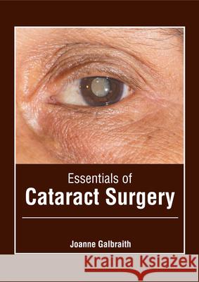 Essentials of Cataract Surgery J Galbraith 9781632429421 Foster Academics
