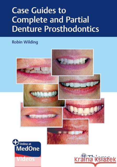 Case Guides to Complete and Partial Denture Prosthodontics Wilding, Robin 9781684201693 Thieme Medical Publishers