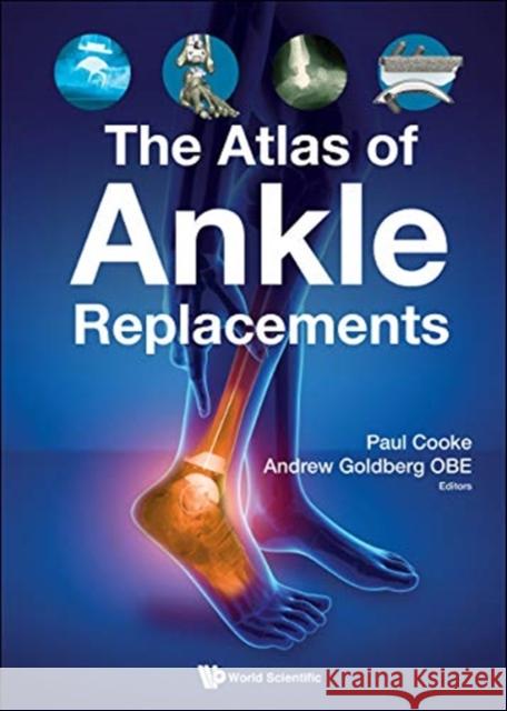 The Atlas of Ankle Replacements Andrew Goldberg Paul Cooke 9781786346230 Wspc (Europe)