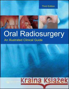 Oral Radiosurgery: An Illustrated Clinical Guide Jeffrey A. Sherman 9781841844619 Taylor & Francis Group
