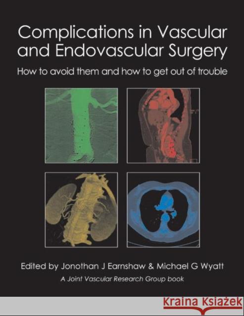 Complications in Vascular and Endovascular Surgery: How to Avoid Them and How to Get Out of Trouble Earnshaw, Jonothan J. 9781903378809 