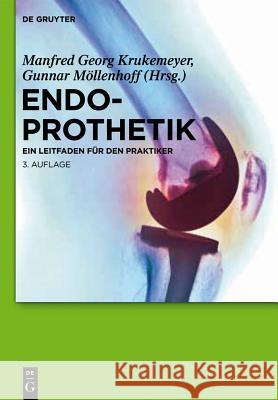Endoprothetik Krukemeyer, Manfred Georg 9783110282610 Walter de Gruyter