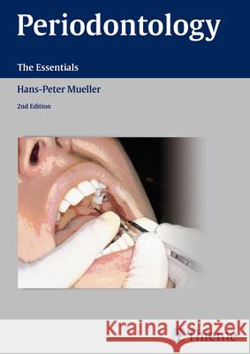 Periodontology: The Essentials Müller, Hans-Peter 9783131383723 Thieme Medical Publishers