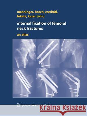 Internal Fixation of Femoral Neck Fractures: An Atlas Manninger, Jenó 9783211685839 Springer