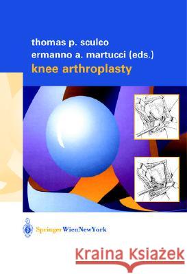 Knee Arthroplasty Ermanno A. Martucci Thomas P. Sculco E. A. Martucci 9783211835319 Springer