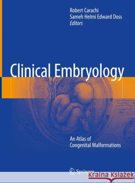 Clinical Embryology: An Atlas of Congenital Malformations Carachi, Robert 9783319261560 Springer