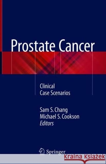 Prostate Cancer: Clinical Case Scenarios Chang, Sam S. 9783319786452 Springer
