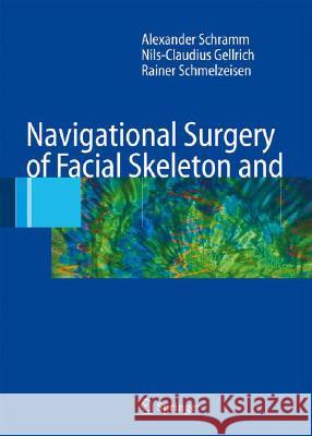 Navigational Surgery of the Facial Skeleton A. Schramm N. -C Gellrich R. Schmelzeisen 9783540223573 Springer
