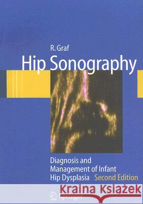 Hip Sonography: Diagnosis and Management of Infant Hip Dysplasia Graf, R. 9783540309574 Springer