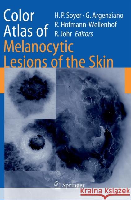 Color Atlas of Melanocytic Lesions of the Skin Giuseppe Argenziano Hans Peter Soyer Rainer Hofmann-Wellenhof 9783540351054 Springer
