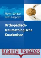 Orthopädisch-Traumatologische Knacknüsse Meyer, Rainer-Peter 9783540714798 Springer