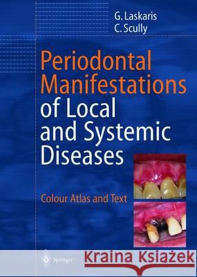 Periodontal Manifestations of Local and Systemic Diseases: Colour Atlas and Text Laskaris, George 9783642627880 