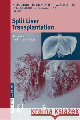 Split Liver Transplantation: Theoretical and Practical Aspects Rogiers, X. 9783798512566 Springer
