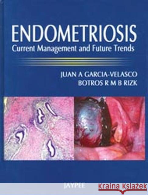 Endometriosis : Current Management and Future Trends Garcia-Velasco, Juan A. 9788184488081 