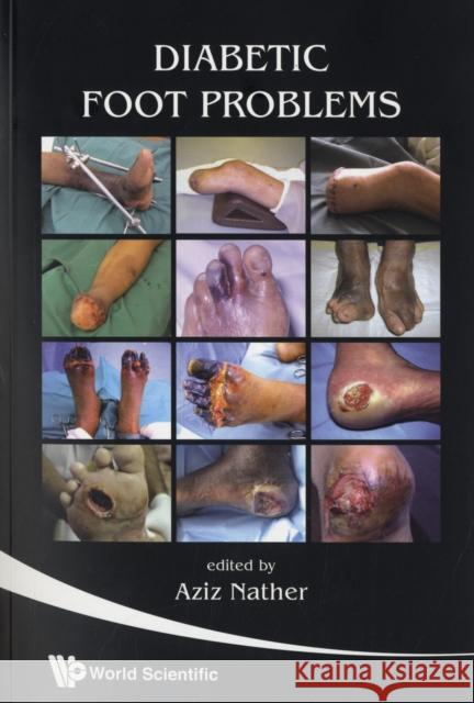 Diabetic Foot Problems Aziz Nather 9789812791528 World Scientific Publishing Company