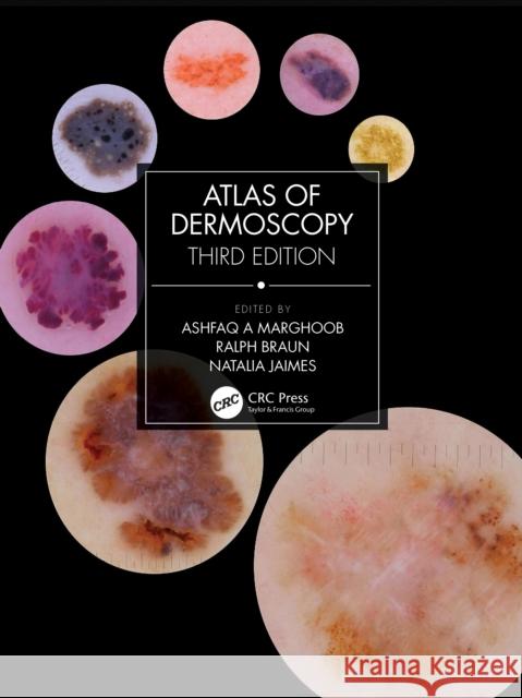 Atlas of Dermoscopy: Third Edition  9781138595989 Taylor & Francis Ltd - książka