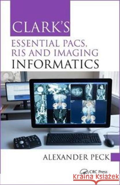 Clark's Essential Pacs, Ris and Imaging Informatics Alexander Peck 9781498763233 Taylor & Francis Inc - książka